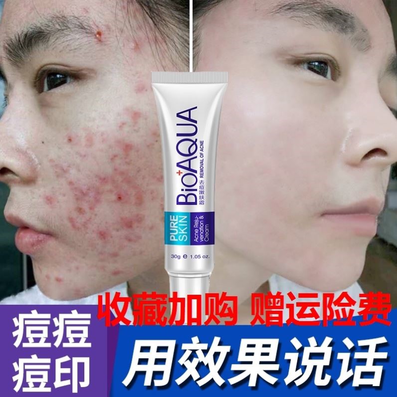 调理脸上痘痘_脸上长脓包型痘痘谁能治好啊_脸上长痘痘怎么调理
