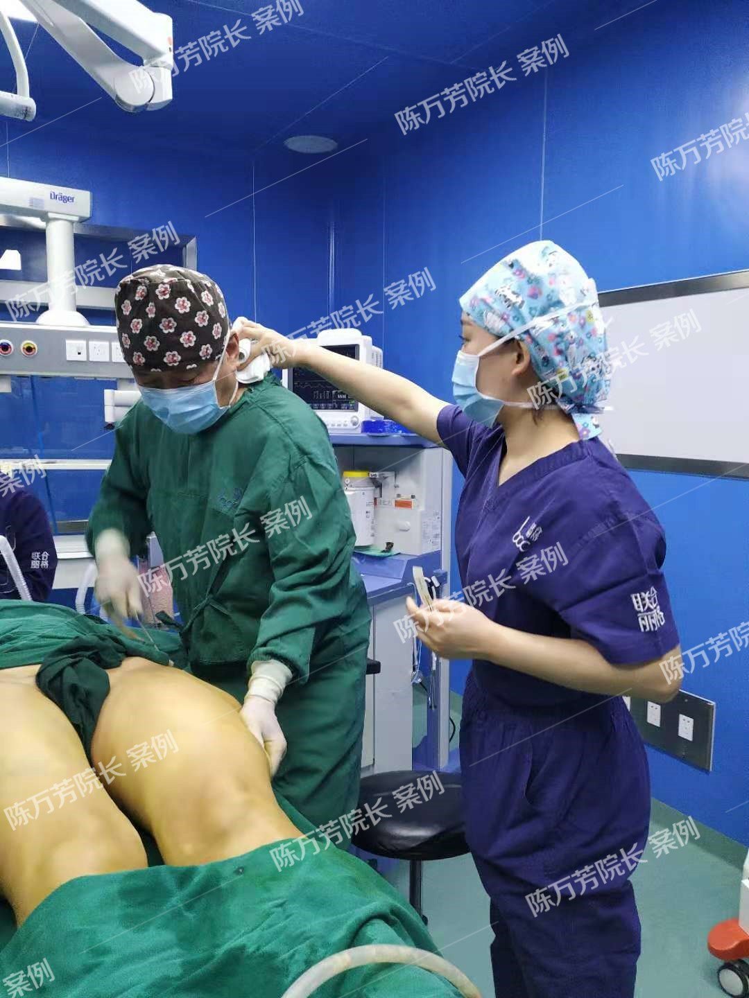 面部抽脂减肥_抽脂减肥好不好_抽脂减肥的副作用