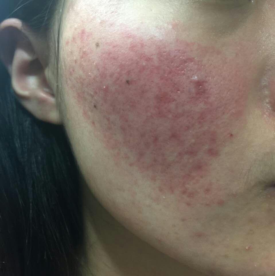 皮肤保养小窍门_皮肤美白窍门_地板保养窍门