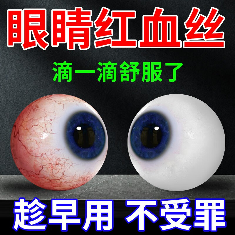 白带出现血丝_眼睛里面出现血丝怎么办_如何防止眼睛出现红血丝