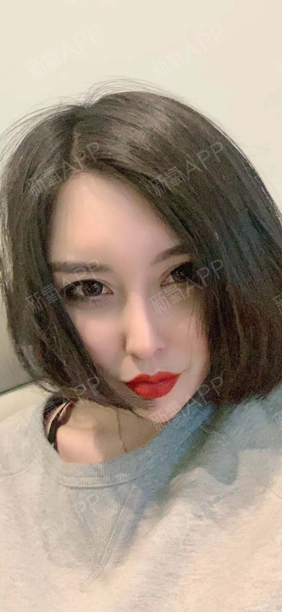 硅胶假体隆鼻取出来后遗症_硅胶隆鼻假体取出_取出硅胶假体隆鼻多久恢复