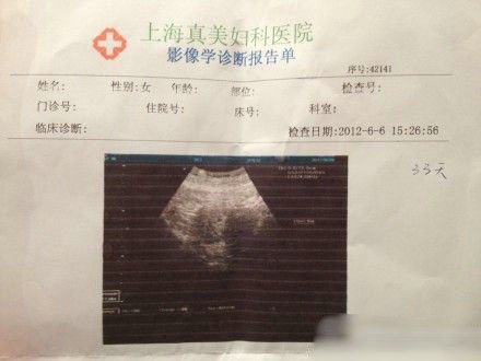 怀孕胎儿男孩女孩的区别_怀孕八个月男胎儿图_怀孕男孩图