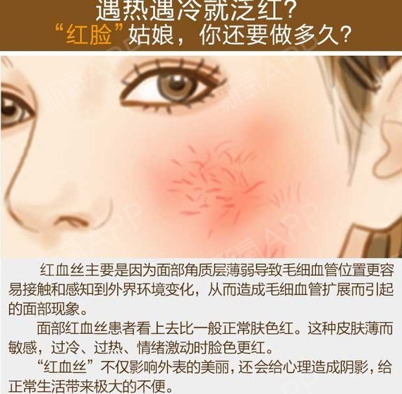 面部那些令人苦恼的红血丝是怎么来的_面部皮肤血丝_面部血丝明显是什么病