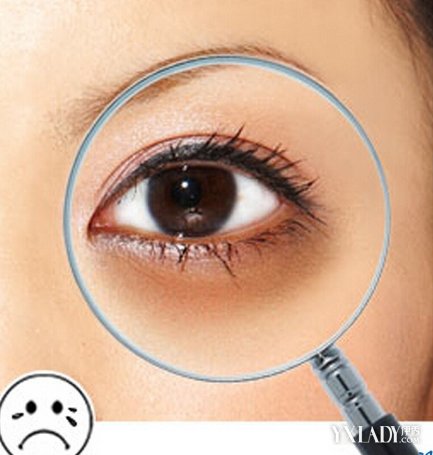 黑眼圈真的是冻出来的?_天冷黑眼圈_眼睛黑眼圈冰敷还是热敷