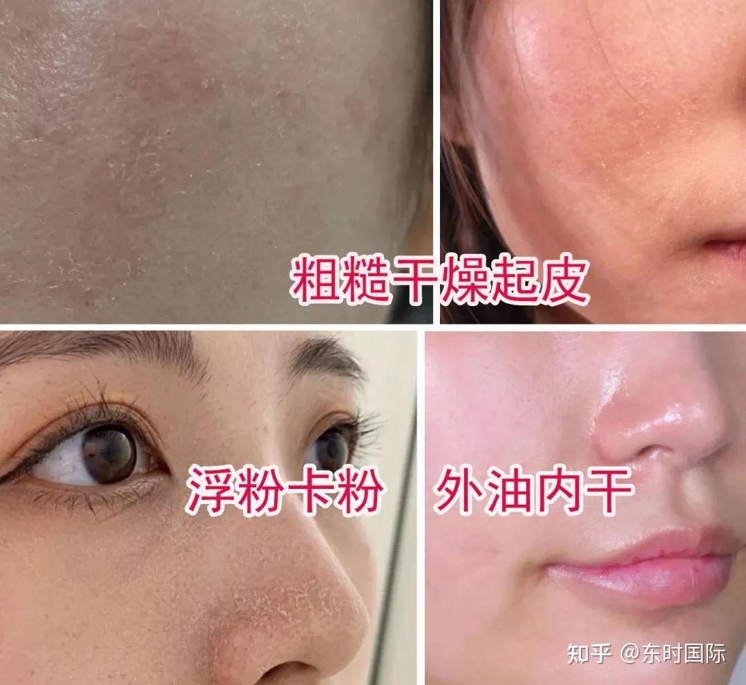 皮肤补水的12个小妙招_皮肤如何补水 的妙招 妙招推荐_妙招皮肤补水推荐用什么