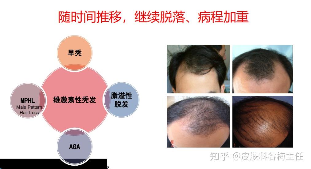 有禁忌男性肌肤问题的药物_男性肌肤问题有哪些 有哪些禁忌_男生肌肤问题