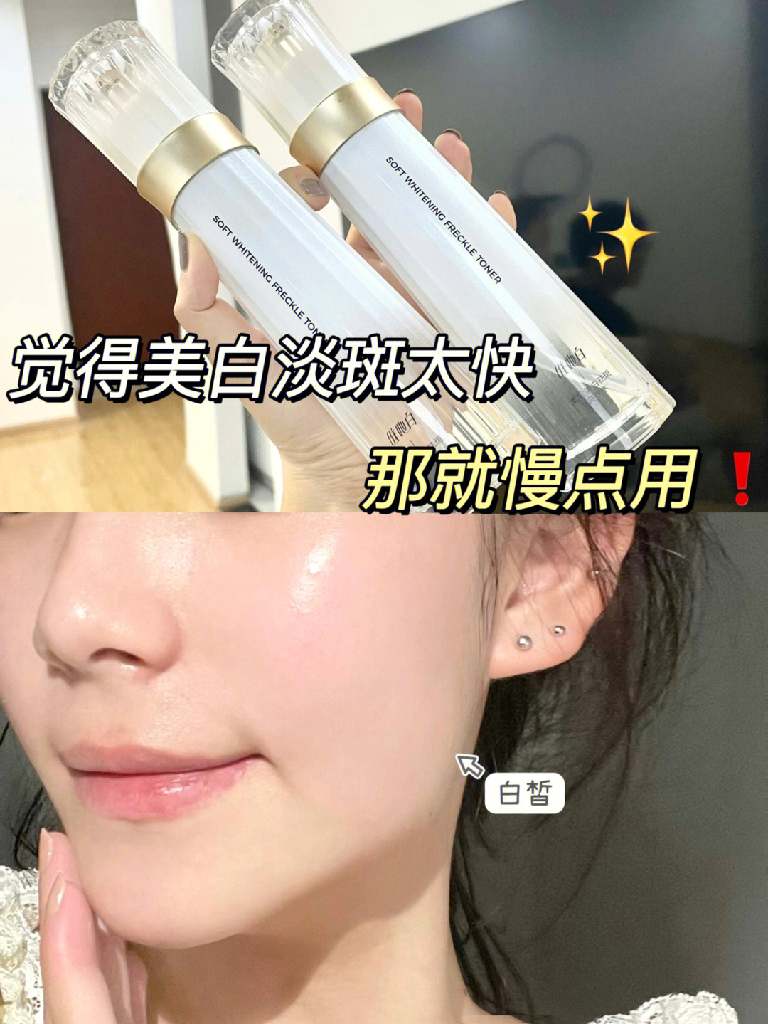 吃黄色食物皮肤变黄怎么办_吃掉黄褐斑的六种食物_4种饮食吃掉黄褐斑 最好的